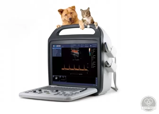 Digitális színes ultrahang diagnosztikai rendszer