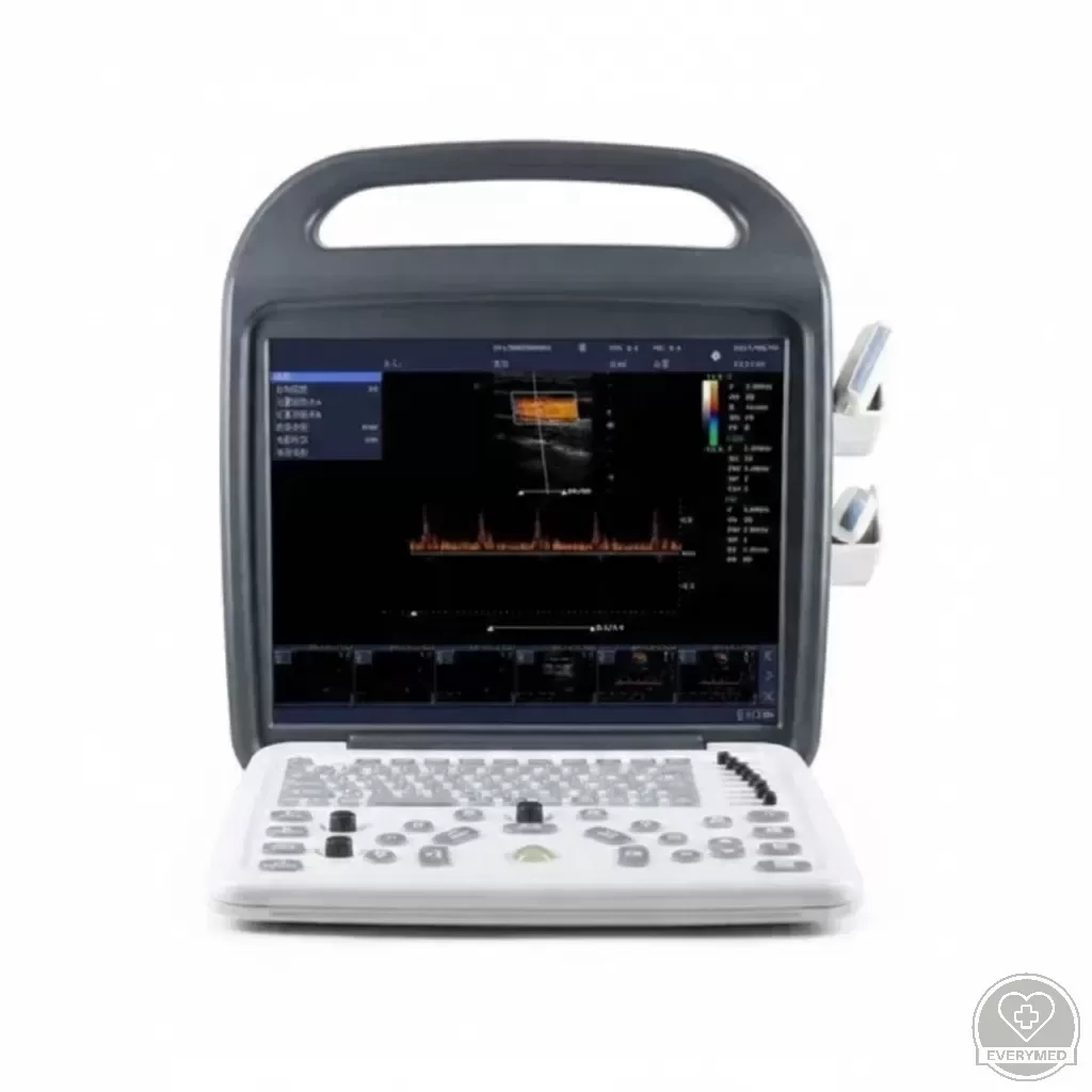 Digitális színes ultrahang diagnosztikai rendszer