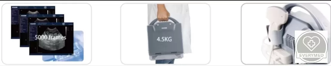 Digitális B-mód ultrahangos készülék