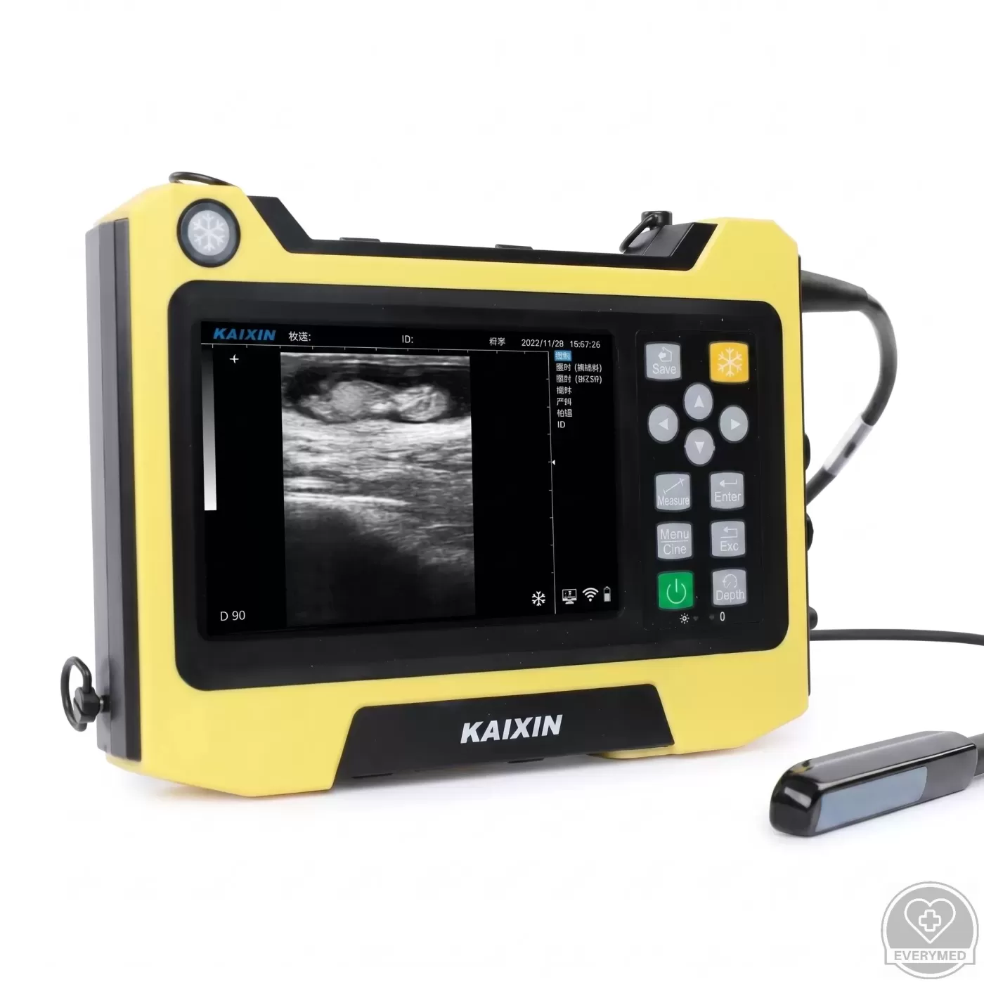 Digitális ultrahangos diagnosztikai készülék