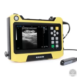 Digitális ultrahangos diagnosztikai készülék